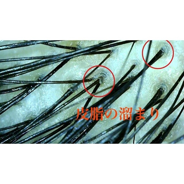 から厳選した 頭皮用 毛穴洗浄 ウォッシング (シャンプー)ブラシ(極細