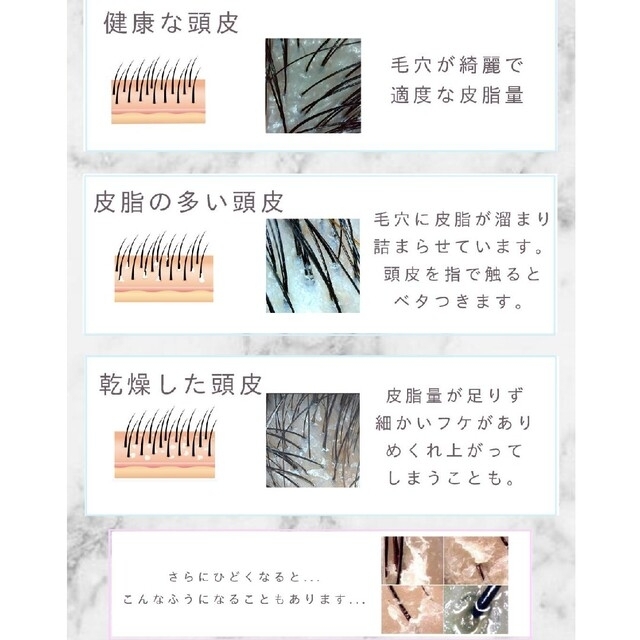 【5個】頭皮用 毛穴洗浄 ウォッシング (シャンプー)ブラシ(極細) 5個セット