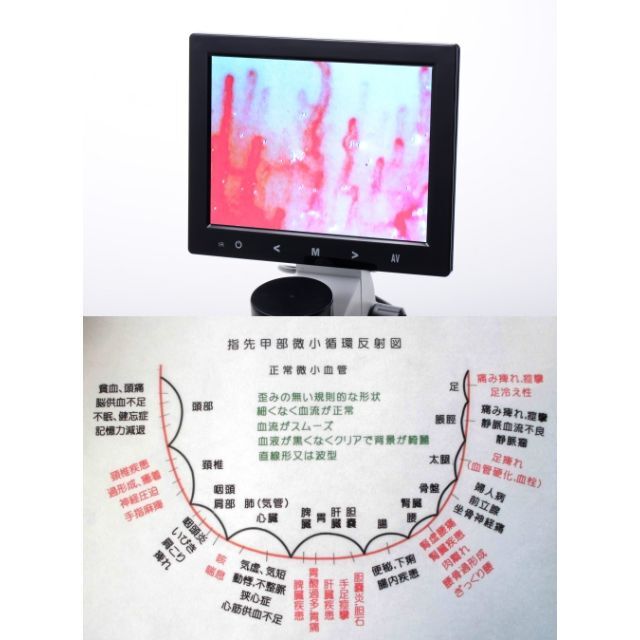新品・送料込・9インチモニター】高倍率 血流スコープ | www.ahsanta.com