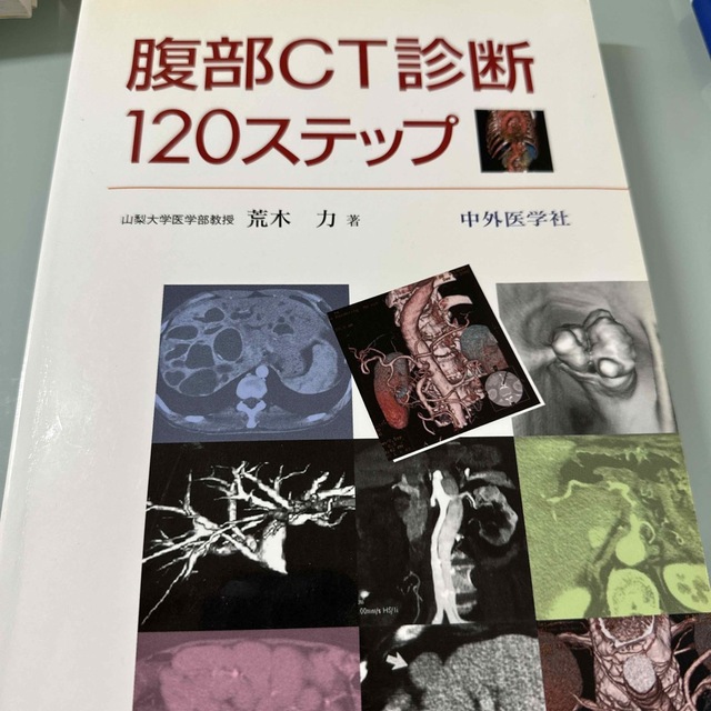 腹部ＣＴ診断１２０ステップ エンタメ/ホビーの本(その他)の商品写真