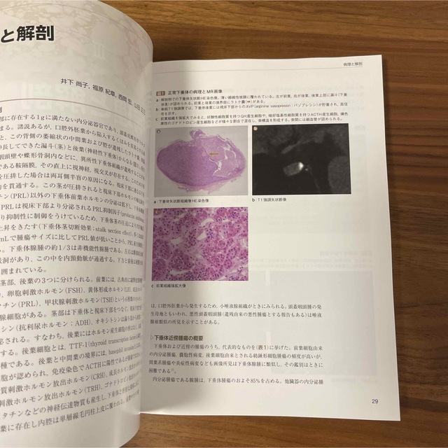 下垂体の画像診断 エンタメ/ホビーの本(健康/医学)の商品写真