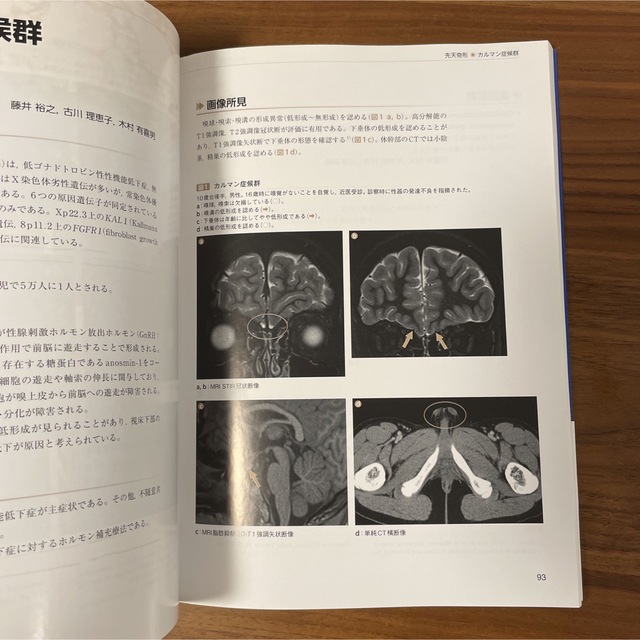 下垂体の画像診断 エンタメ/ホビーの本(健康/医学)の商品写真