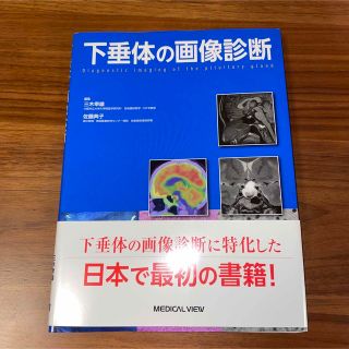 下垂体の画像診断(健康/医学)