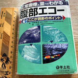 正常画像と並べてわかる腹部エコ－ ここが読影のポイント(健康/医学)