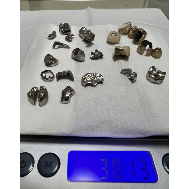 撤去冠 除去冠 銀歯 ゴールド17g 計38g 最新発見 jardinmagico.mx