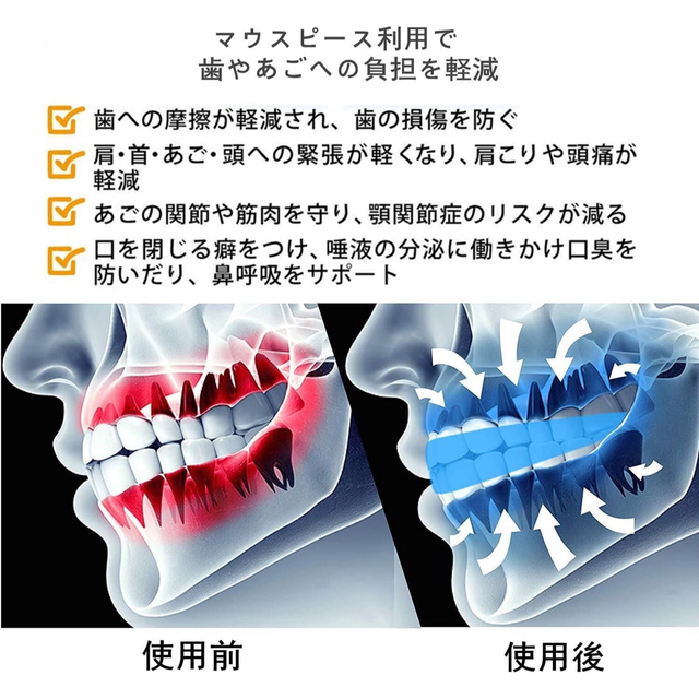 【3セット/6個】自分の歯型で作るオリジナルマウスピース/歯ぎしり/いびき コスメ/美容のオーラルケア(口臭防止/エチケット用品)の商品写真