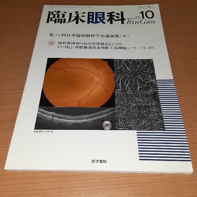 臨床眼科 2021年 10月号 エンタメ/ホビーの雑誌(専門誌)の商品写真