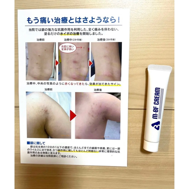 格安本物保証】 新品未使用 M-BF CREAM 水いぼ 水イボ クリーム 2本の