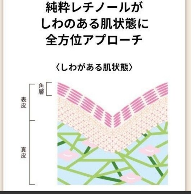 ELIXIR SUPERIEUR（SHISEIDO）(エリクシールシュペリエル)のエリクシール エンリッチド リンクルクリーム L  薬用 しわ改善 ハリ(22g コスメ/美容のスキンケア/基礎化粧品(フェイスクリーム)の商品写真