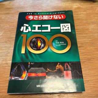 今さら聞けない心エコ－図１００(健康/医学)