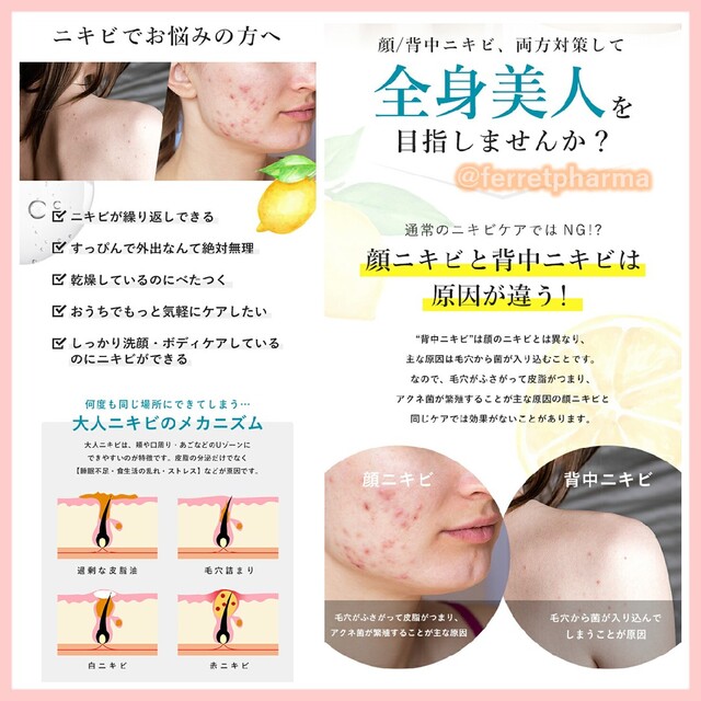 【薬用】VELUS ニキビ専科ジェルクリーム 美白PLUS 50g 1個 コスメ/美容のスキンケア/基礎化粧品(フェイスクリーム)の商品写真