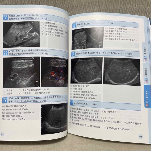 超音波検査士認定試験対策 臨床編:消化器領域 エンタメ/ホビーの本(資格/検定)の商品写真