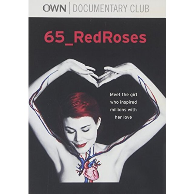 65 Redroses [DVD]