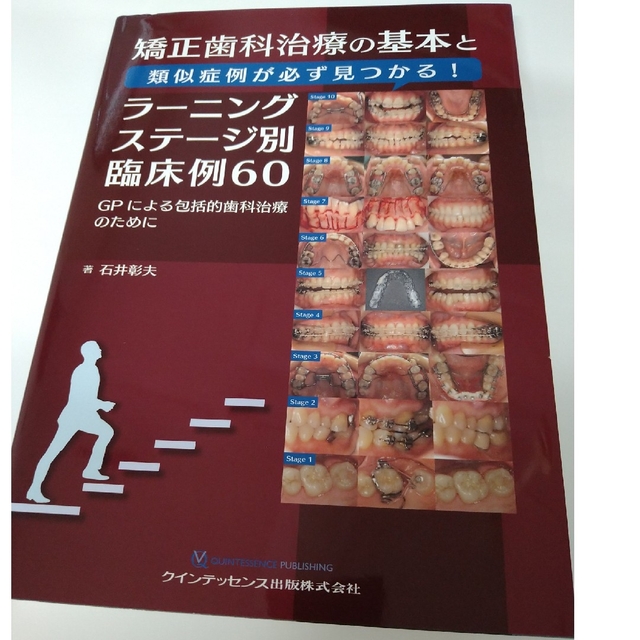 【裁断】矯正歯科治療の基本と類似症例が必ず見つかるラーニングステージ別臨床例60