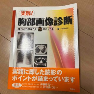 実践！胸部画像診断 押さえておきたい２４のポイント(健康/医学)