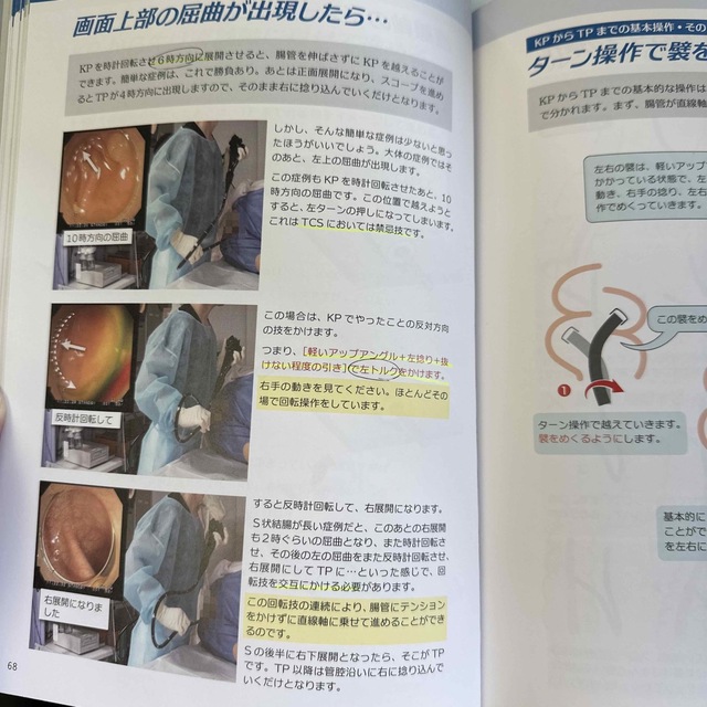 カール先生の大腸内視鏡挿入術 「Ｎｏｎ－ｌｏｏｐ法」の挿入理論とテクニック エンタメ/ホビーの本(健康/医学)の商品写真