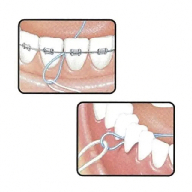 GUMフロススレッダー　歯科矯正、ブリッジ用  1パック5個入り　新品未使用 コスメ/美容のオーラルケア(歯ブラシ/デンタルフロス)の商品写真