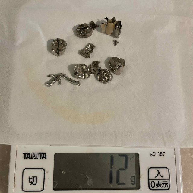 歯科 金属 歯科 金属