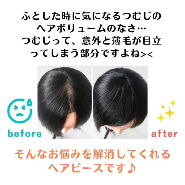 つむじ 頭頂部 ウィッグ ヘアピース 円形脱毛症 薄毛 ダーク ブラウンの通販 by さくちゃん つむじ 頭頂部 ウィッグ ヘアピース 円形脱毛症 薄毛 ダーク ブラウン