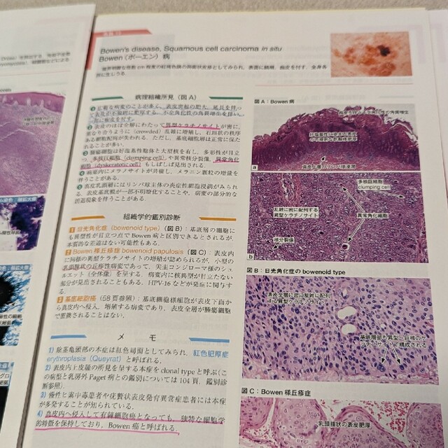 皮膚病理組織診断学入門 改訂第３版（裁断済） エンタメ/ホビーの本(健康/医学)の商品写真