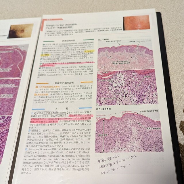 皮膚病理組織診断学入門 改訂第３版（裁断済） エンタメ/ホビーの本(健康/医学)の商品写真