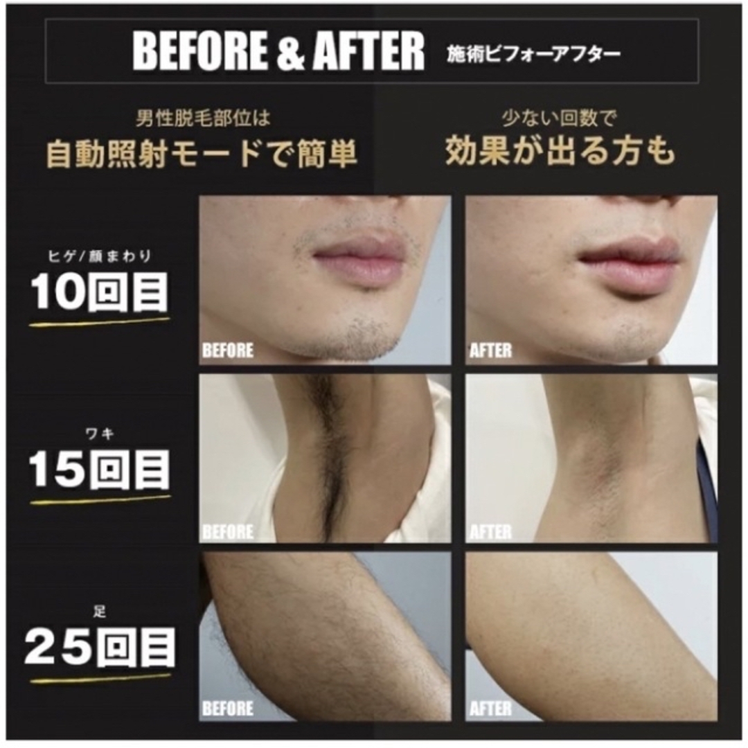 脱毛器 JOVS Dora ピュアホワイトの通販 by HNN|ラクマ
