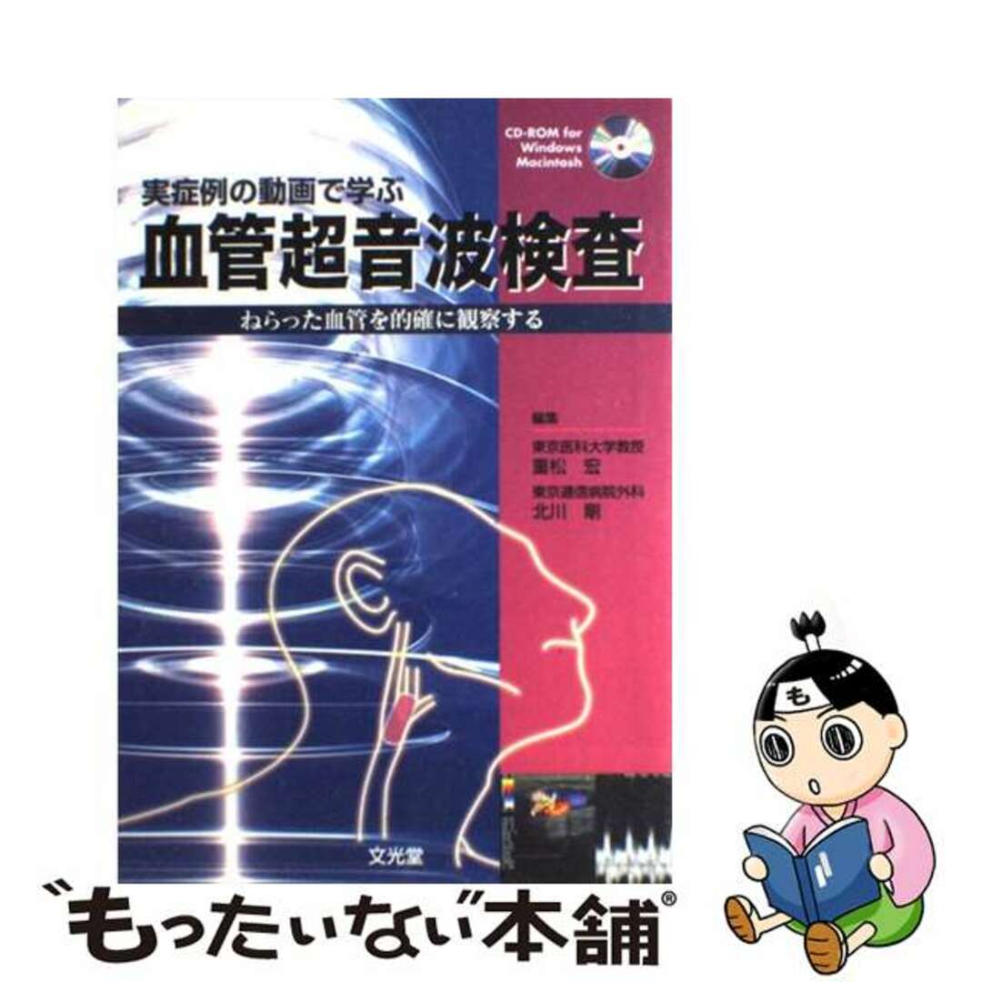 実症例の動画で学ぶ血管超音波検査 ねらった血管を的確に観察する/文光堂/重松宏