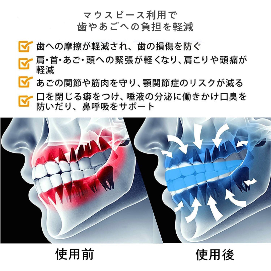 評価 1セット 2個入 自分の歯型で作るオリジナルマウスピース 説明書付