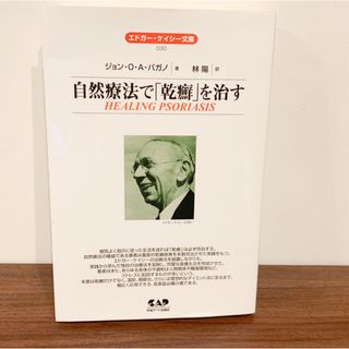 自然療法で「乾癬」を治す　エドガー・ケイシー(健康/医学)