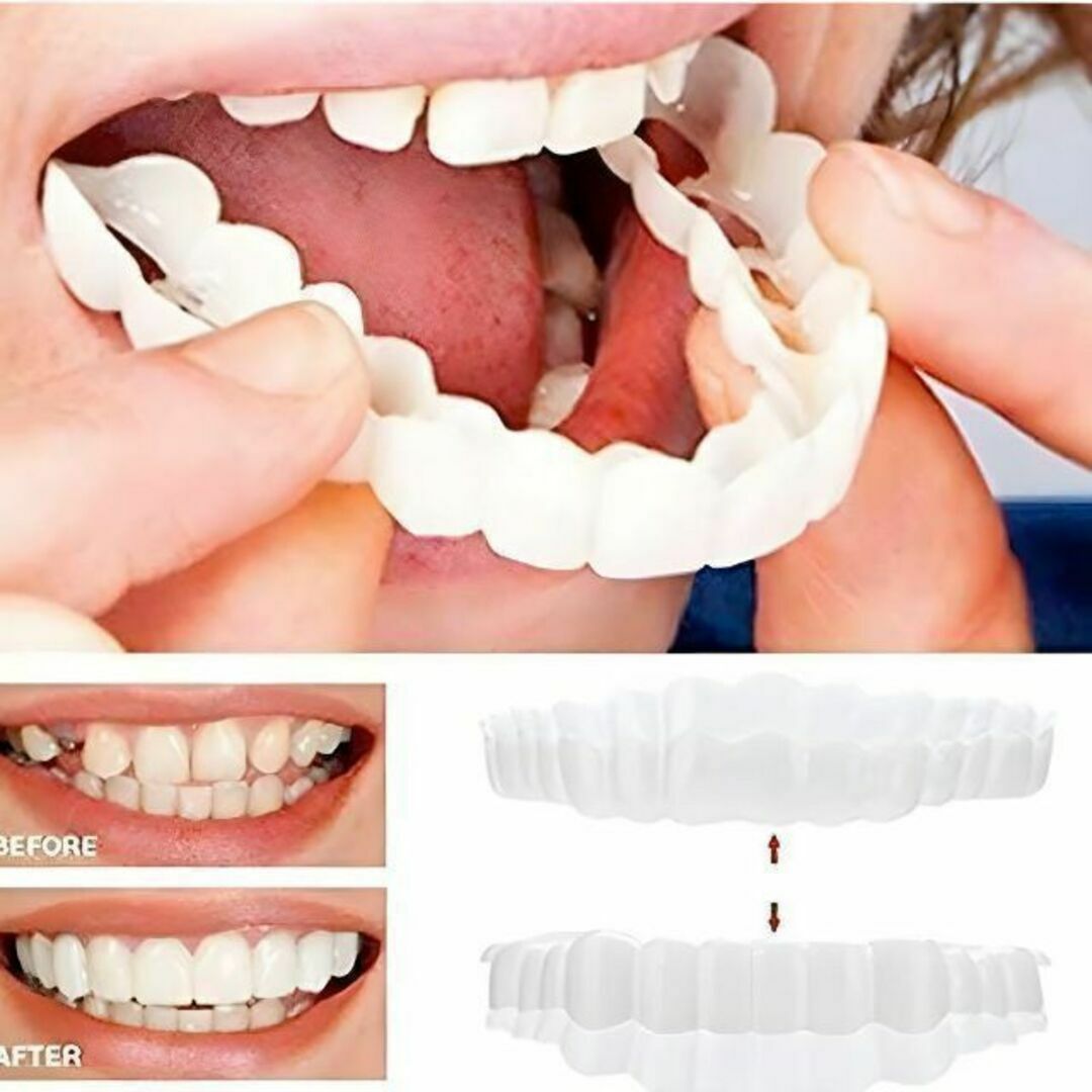 マウスピース 矯正 つけ歯 入れ歯 義歯 オーラルケア ホワイトニング かぶせ コスメ/美容のオーラルケア(口臭防止/エチケット用品)の商品写真