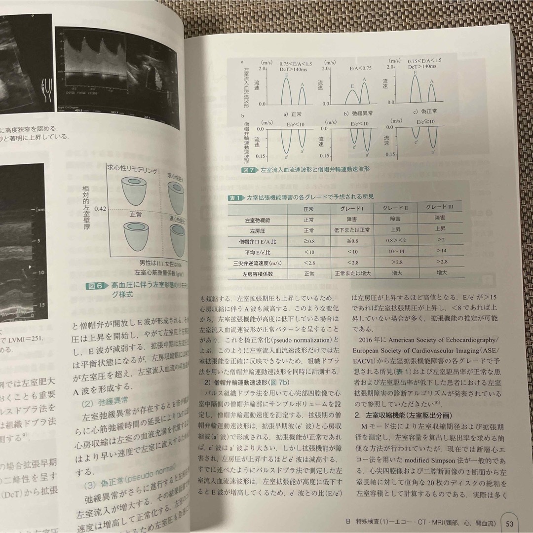 高血圧診療ステップアップ 高血圧治療ガイドラインを極める 改訂新版 エンタメ/ホビーの本(健康/医学)の商品写真