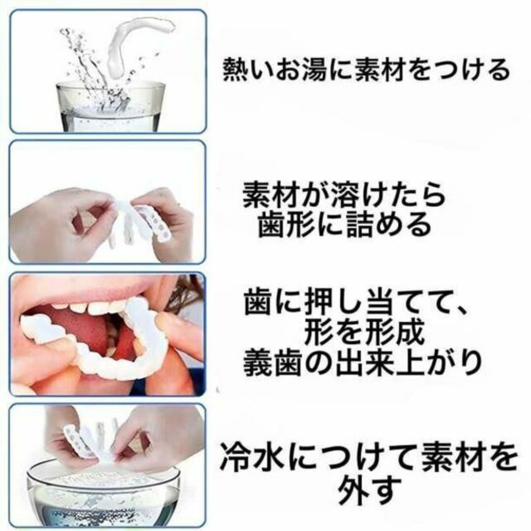 マウスピース 矯正 差し歯 入れ歯 ホワイトニング 義歯 オーラルケア