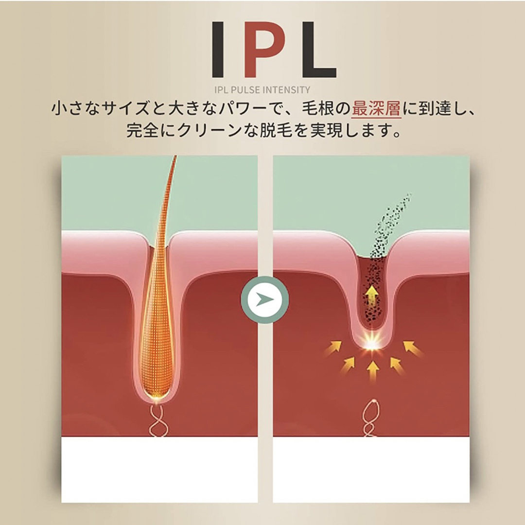 脱毛器 IPL光脱毛器 99万照射無痛脱毛 男女兼用 5段階自動照射 全身適用 スマホ/家電/カメラの美容/健康(レディースシェーバー)の商品写真