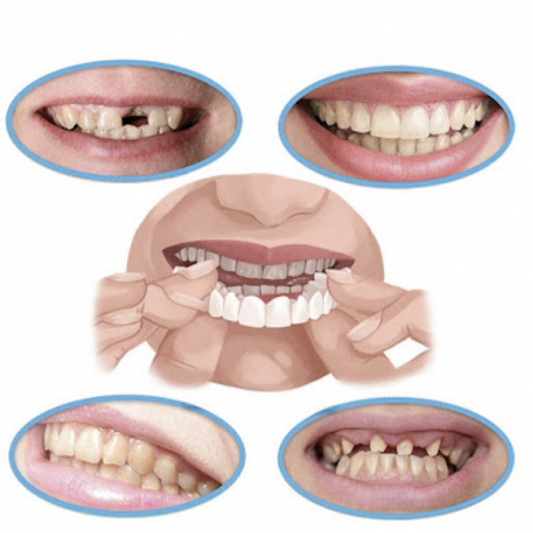 歯 ウィッグ マウスピース 上下2個セット 義歯 付け歯 オーラルケア コスメ/美容のオーラルケア(口臭防止/エチケット用品)の商品写真