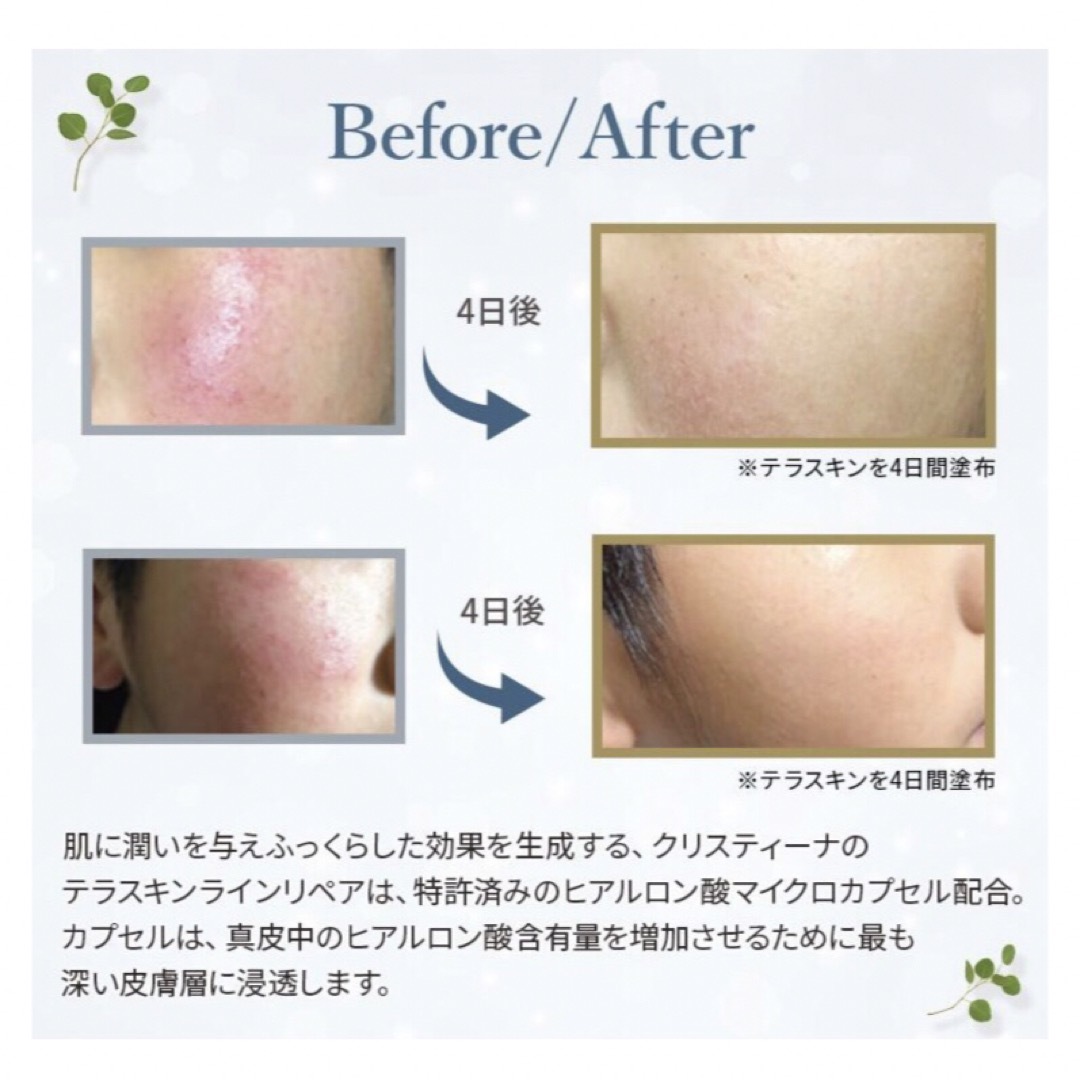 【新品】クリスティーナ テラスキン ラインリペア 30ml 正規品 6