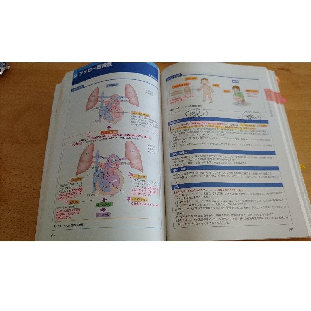 発達段階からみた小児看護過程＋病態関連図 第２版 エンタメ/ホビーの本(健康/医学)の商品写真