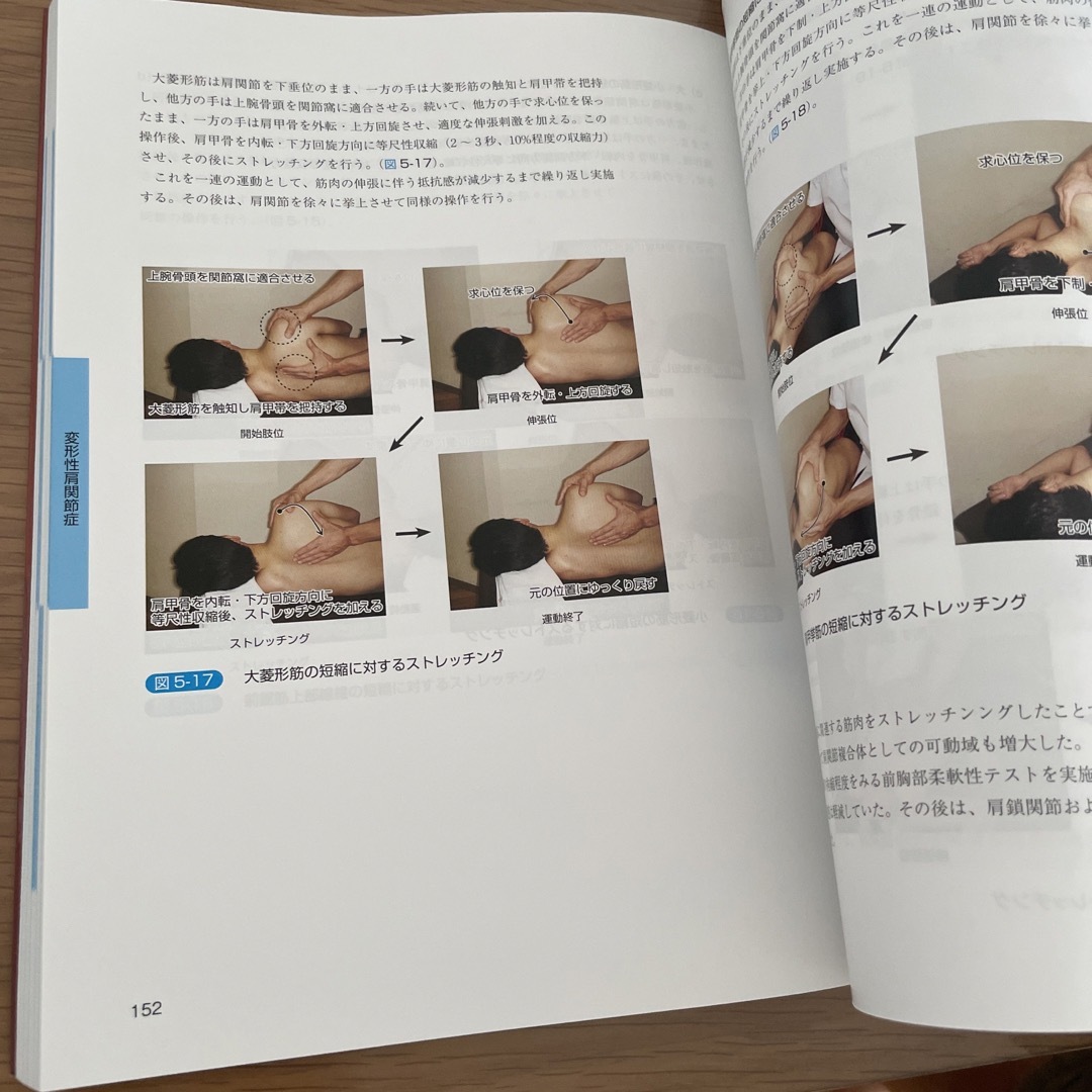肩関節拘縮の評価と運動療法　臨床編 エンタメ/ホビーの本(健康/医学)の商品写真