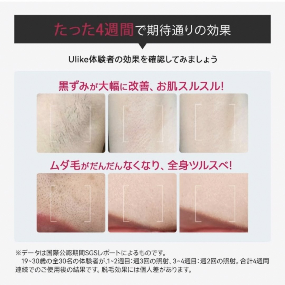 Ulike Air IPL光美容器 脱毛器 VIO対応 レーザー脱毛器美容/健康