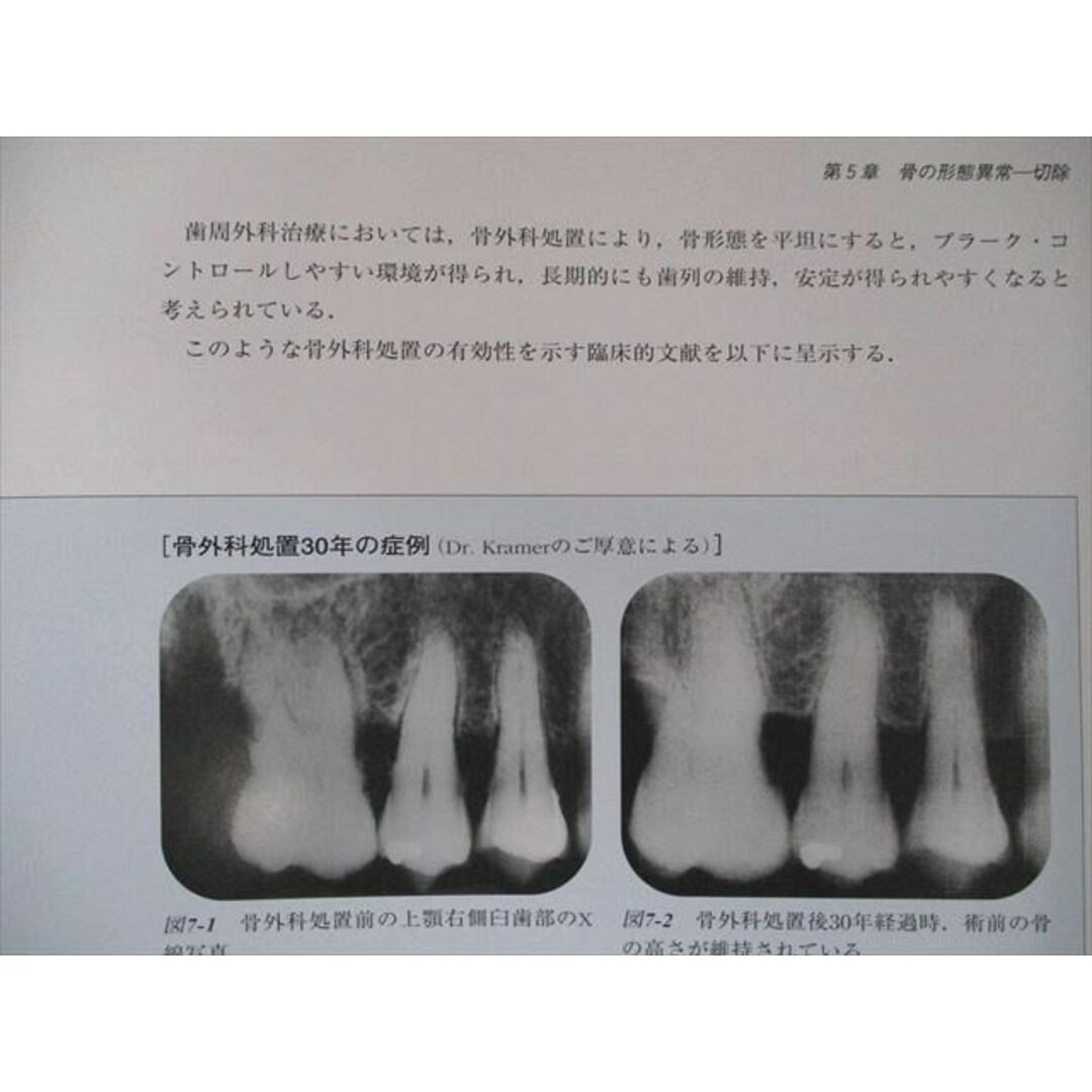 UP クインテッセンス出版 コンセプトをもった予知性の高い歯周