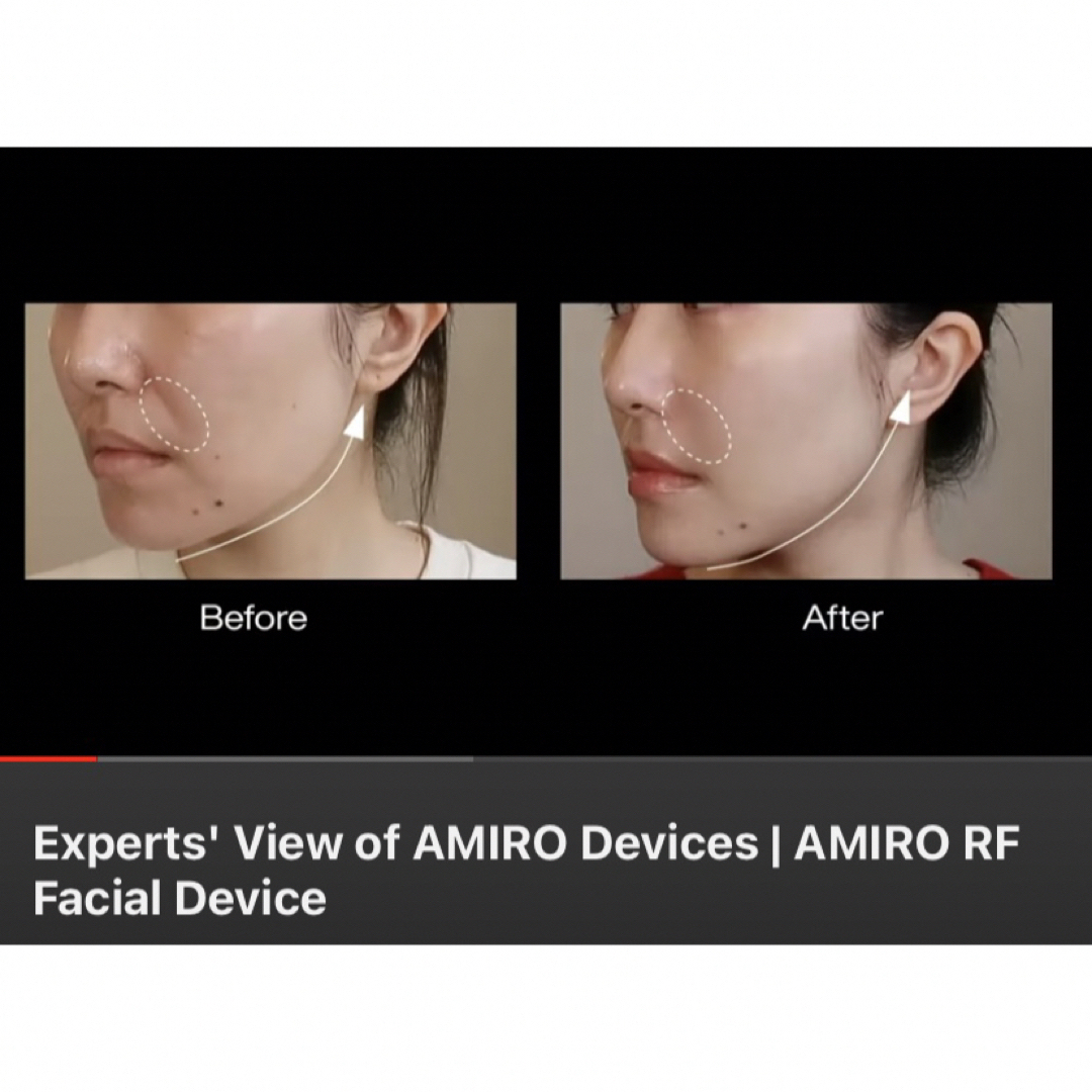 値下げ!AMIRO 美顔器 EMS 1台10役 ラジオ波-itesil.org