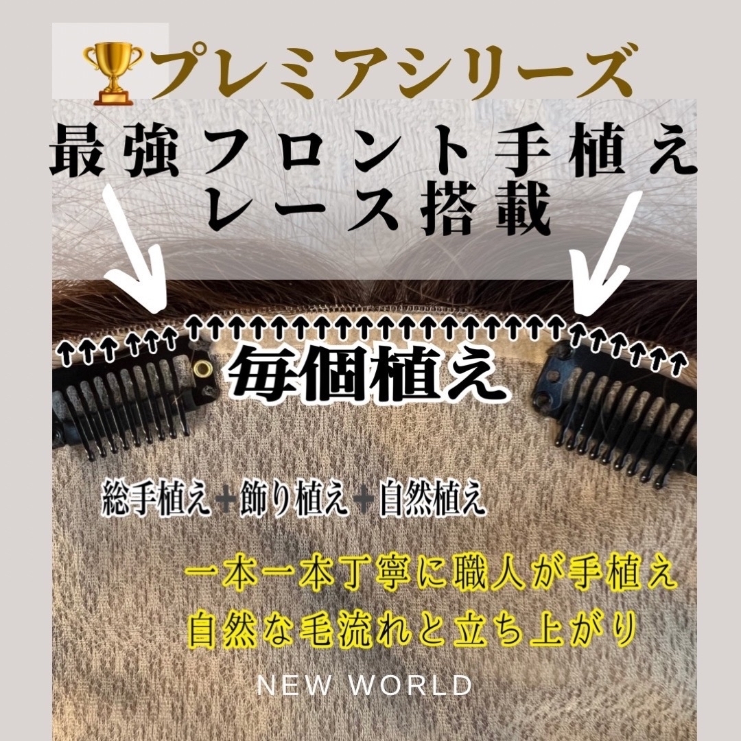 円形脱毛症新世界プレミア最新9*14総手植え45㌢〜 前縁まで植毛されており縁が見えにくい