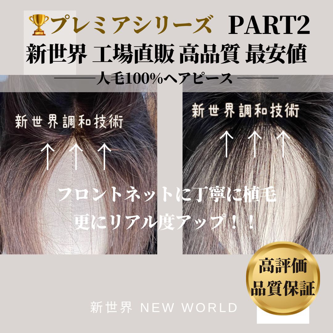 円形脱毛症新世界プレミア最新9*14総手植え45㌢〜 前縁まで植毛されており縁が見えにくい