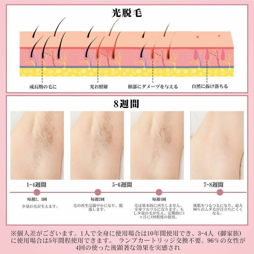 ⭐️夏までにツルツル⭐️ IPL光脱毛器 99万回照射 5段階調節 家庭用