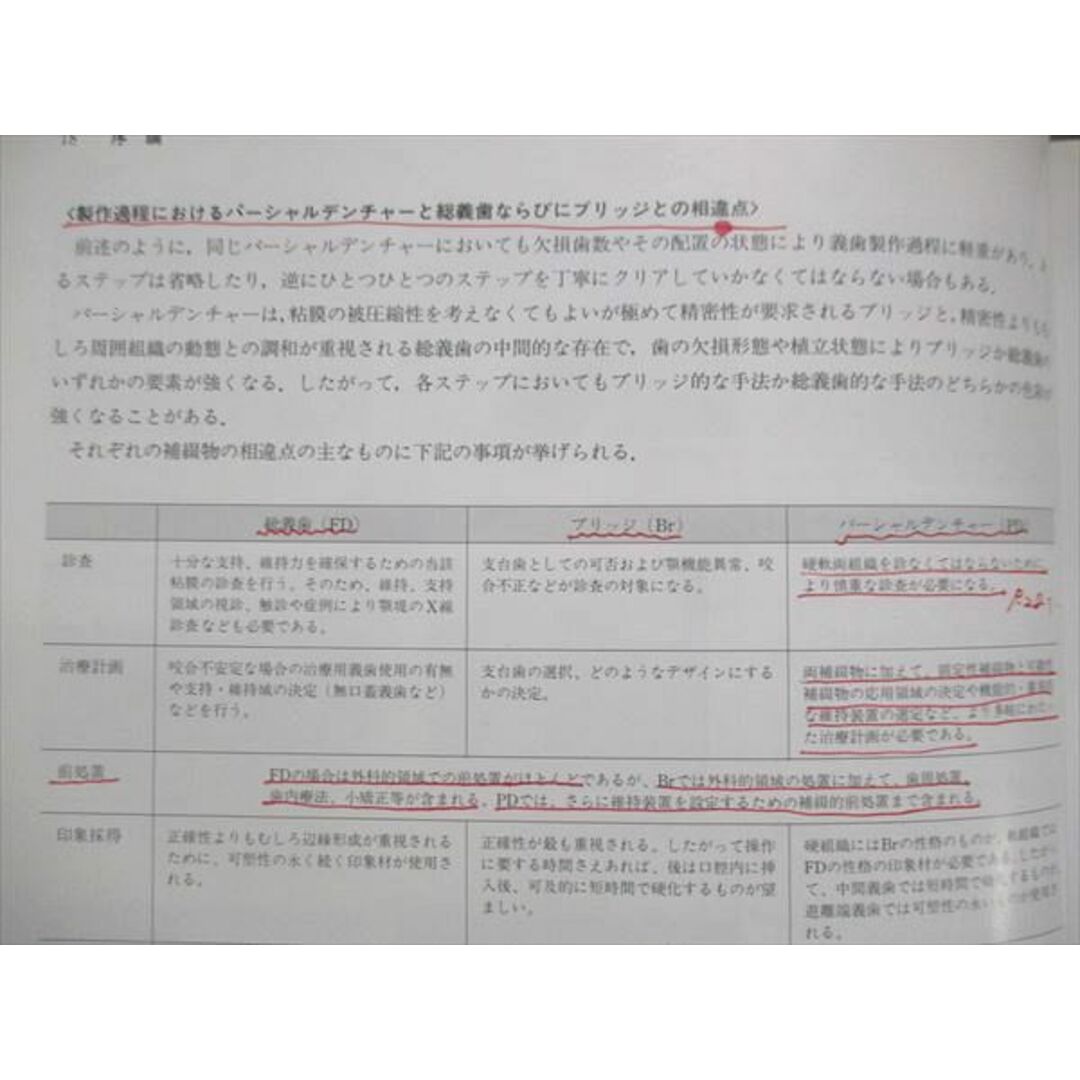 パーシャルデンチャー その考え方と臨床 [単行本] 守川 雅男