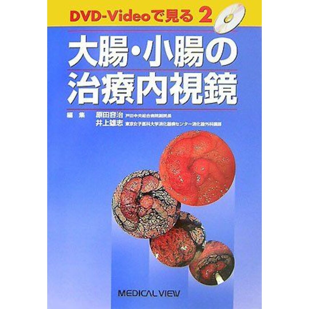 大腸・小腸の治療内視鏡 (DVD-Videoで見る治療内視鏡 2) 容治，原田; 雄志，井上 エンタメ/ホビーの本(語学/参考書)の商品写真