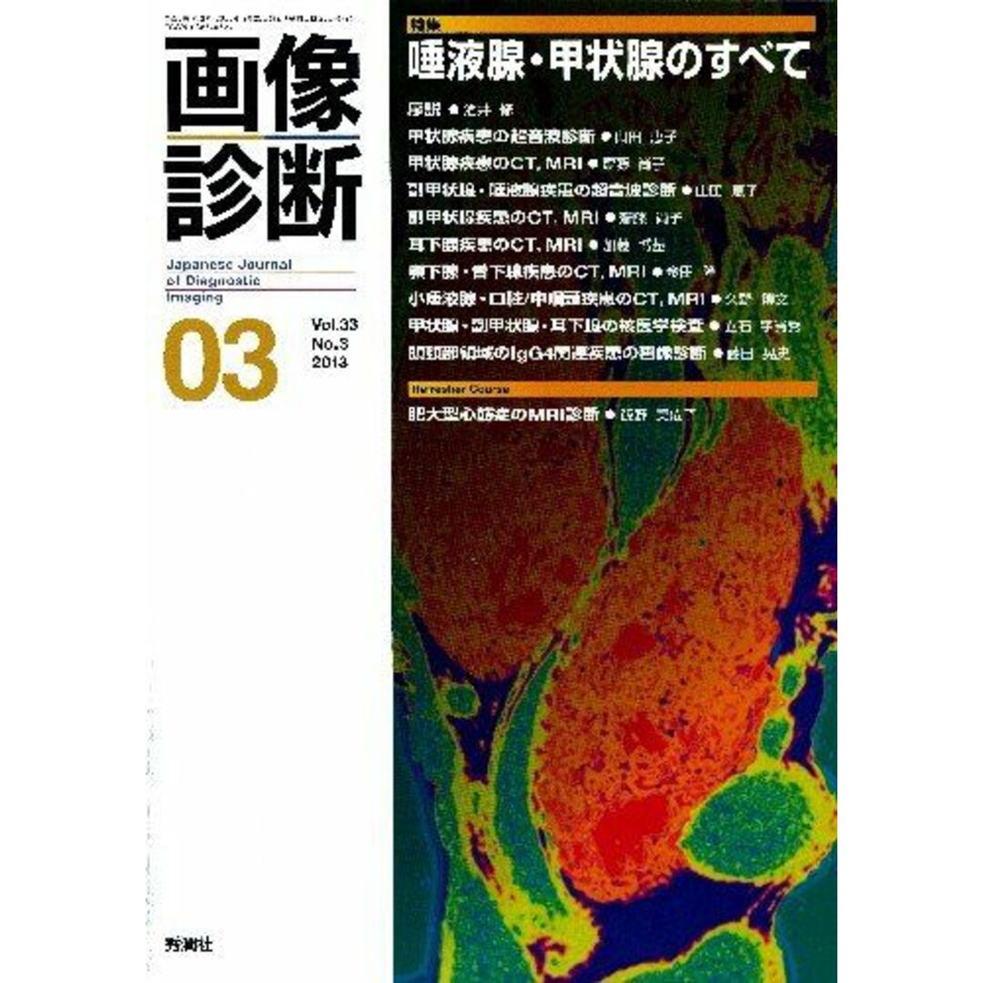 画像診断 13年3月号 33ー3 特集:唾液腺・甲状腺のすべて