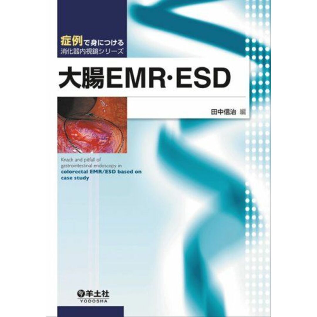 大腸EMR・ESD (症例で身につける消化器内視鏡シリーズ) [単行本] 信治，田中 エンタメ/ホビーの本(語学/参考書)の商品写真