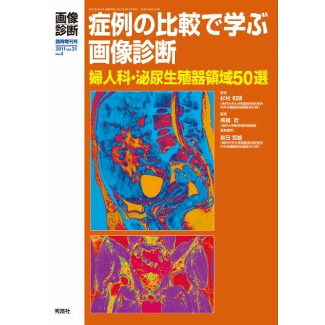 画像診断 11年臨時増刊号 31―4―婦人科・泌尿器生殖器領域50選 症例の比較で学ぶ画像診断 高橋 哲; 前田 哲雄