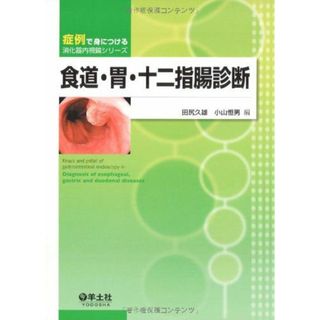 食道・胃・十二指腸診断 (症例で身につける消化器内視鏡シリーズ) [単行本] 田尻 久雄(語学/参考書)