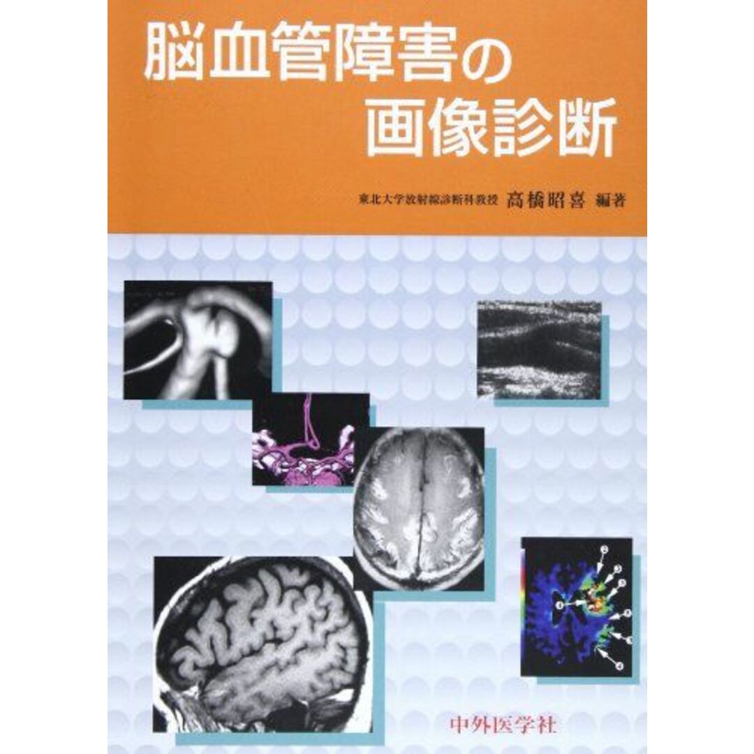 脳血管障害の画像診断 [単行本] 高橋 昭喜
